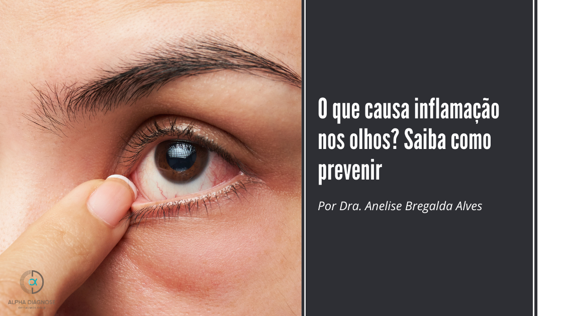 Terçol: o que é, qual a causa e qual é o tratamento - Ser Saúde