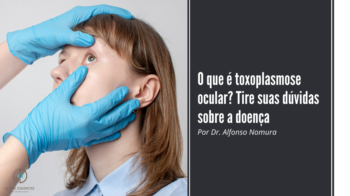 Três maneiras de tratar o terçol - Alpha Diagnose Oftalmologia